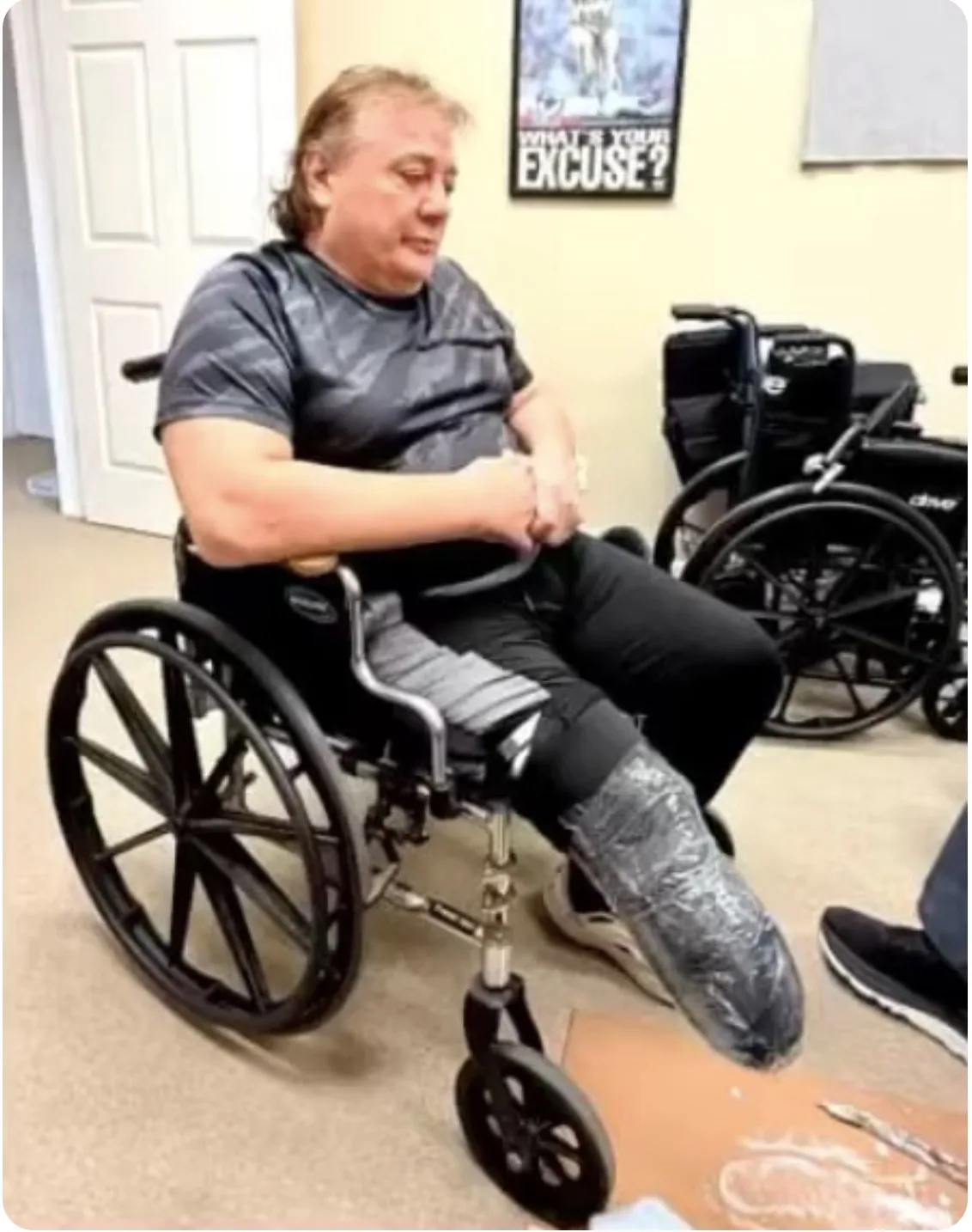 Marty Jannetty е претърпял ампутация