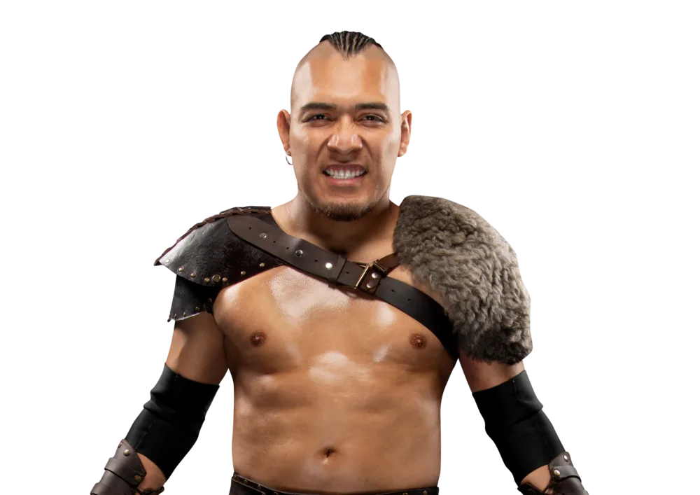 Неприятен ъпдейт за El Hijo Del Vikingo по време на възстановяването му от контузия